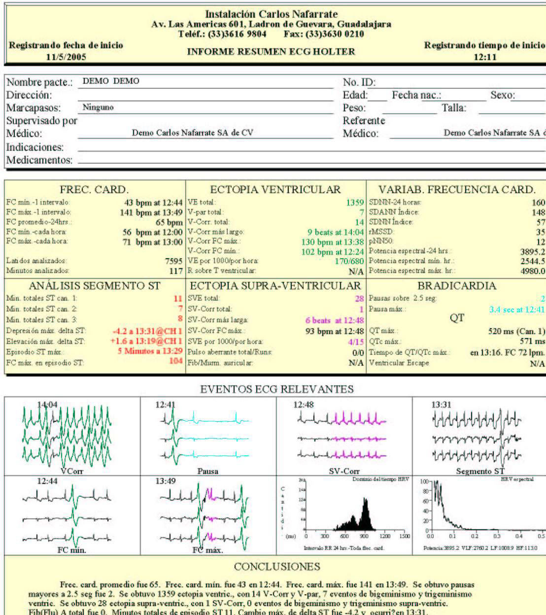 Página fontal del reporte Holter CardioScan