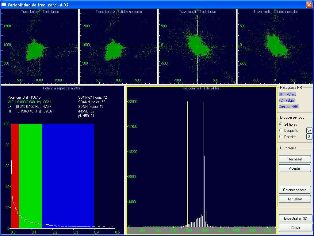 Variabilidad de la frecuencia cardiaca Holter CardioScan