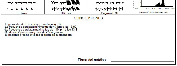 Conclusiones personalizadas